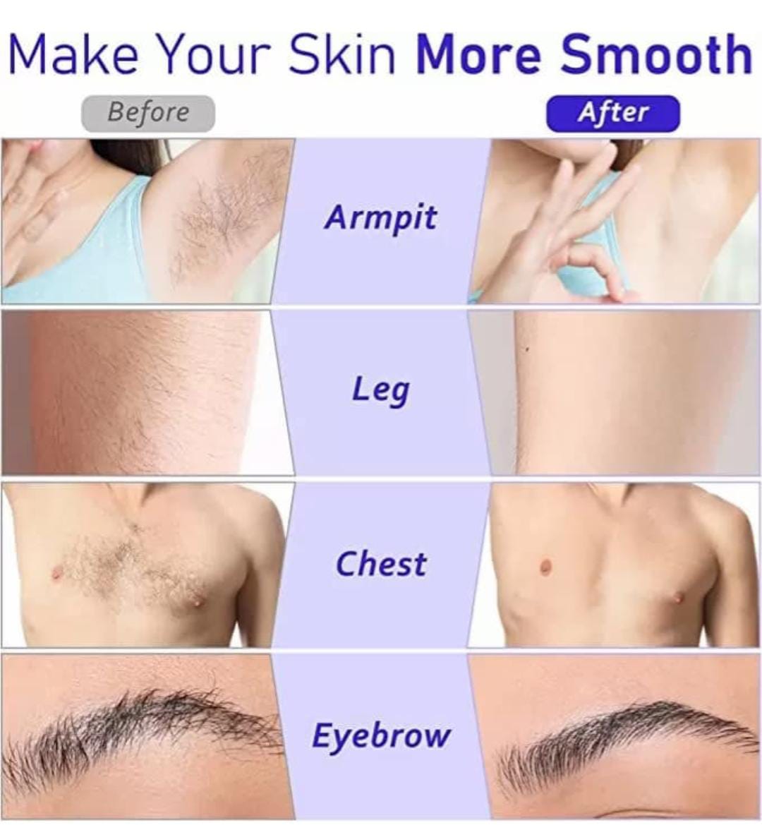 3-in-1 Depilatory Wax Heater & Roll-On Epilator – Full-Body Hair Removal